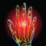 hand x ray pain render